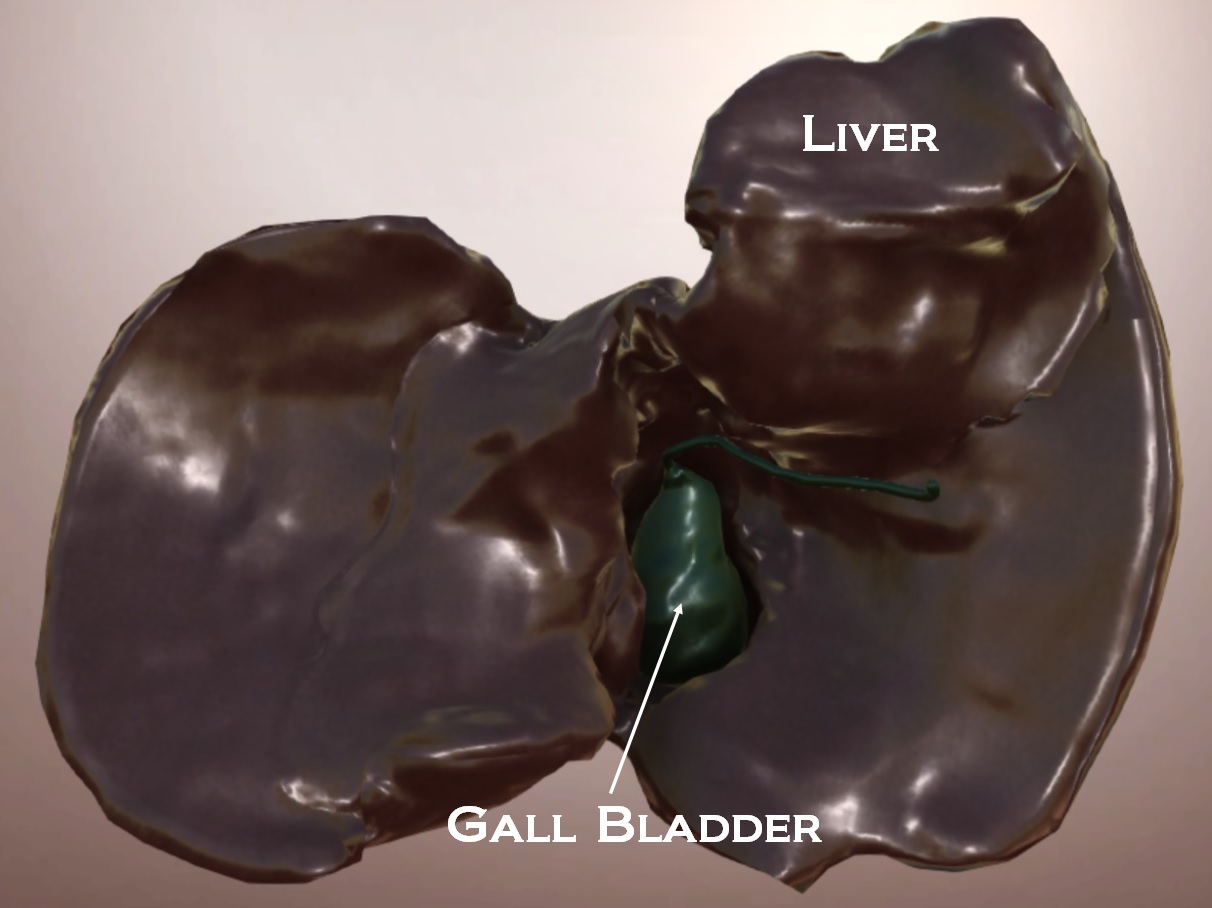 ruptured-gall-bladder-case-of-the-week-from-dr-john-glauser