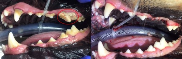 slab fracture before after